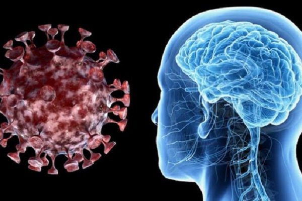  COVID-19 may cause loss of brain tissue, Study says