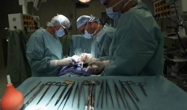 India After Five Years Scissors Removed From Woman Stomach