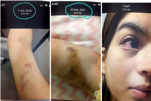  Domestic Violence: Aliza shares evidence of Feroze Khan violent