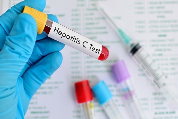  Pakistan goes over its aim of reducing hepatitis by 2030